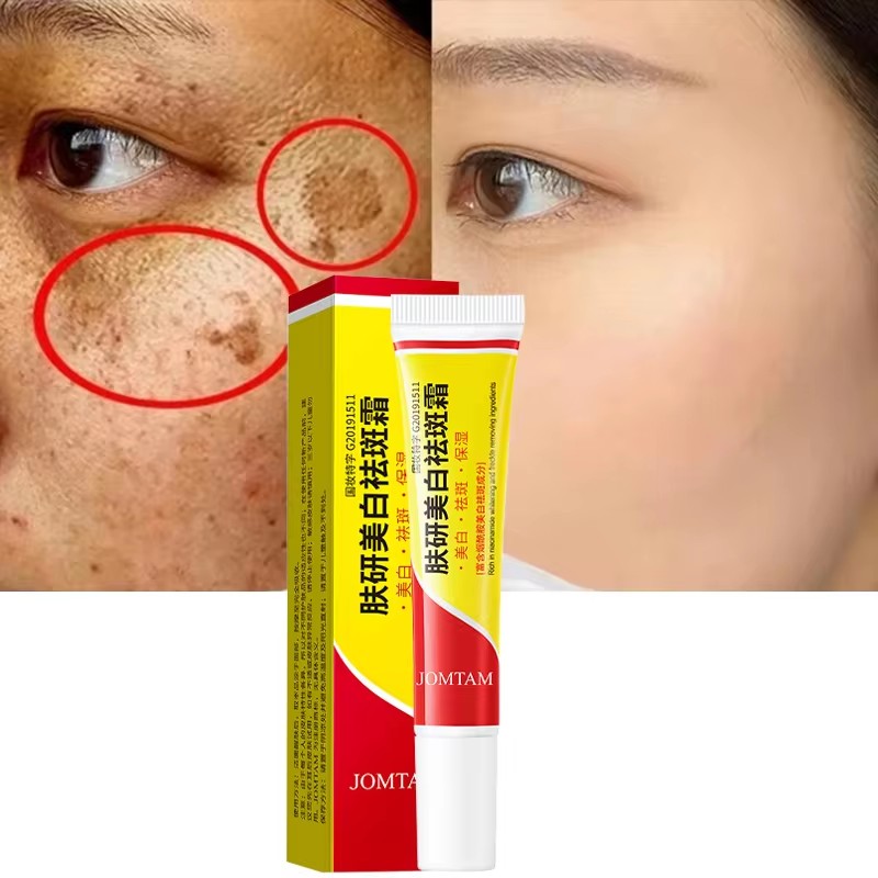 Whitening Freckle Cream Face B - Skincare Glad2Glow reseña y precio