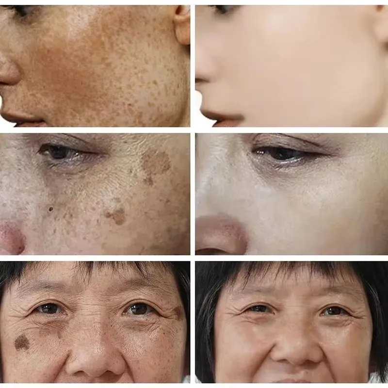 Whitening Freckle Cream Face B - Skincare Glad2Glow reseña y precio
