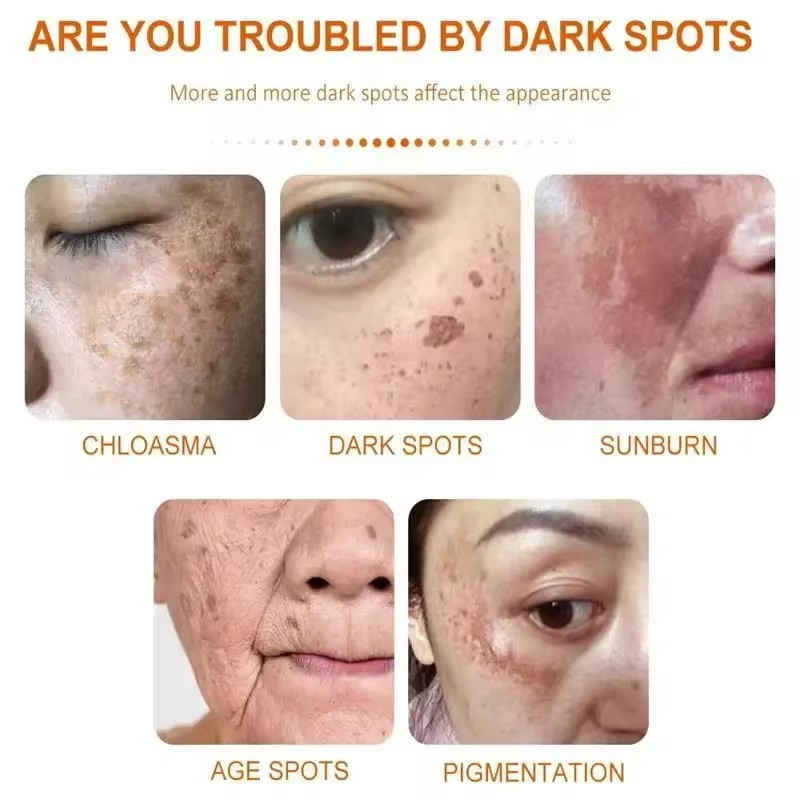 Whitening Freckle Cream Face B - Skincare Glad2Glow reseña y precio