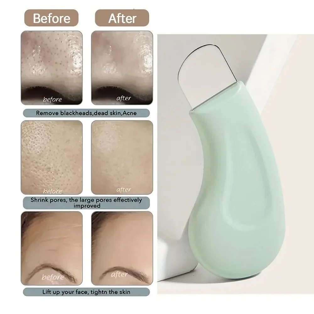 Deep Cleansing Blackhead White - Skincare Routine reseña y precio