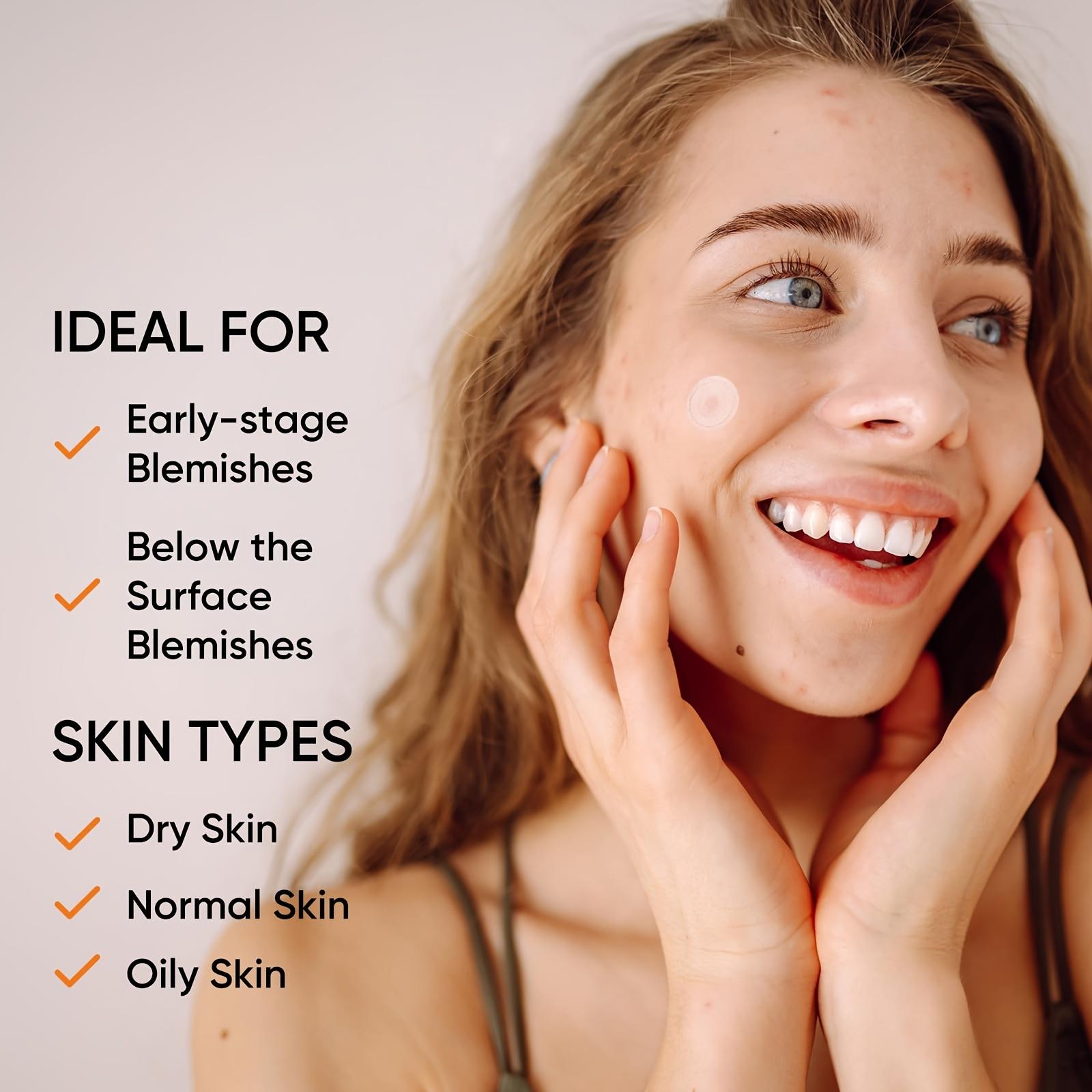 Large Hydrogel Acne Patches Xl - Xl Skincare reseña y precio