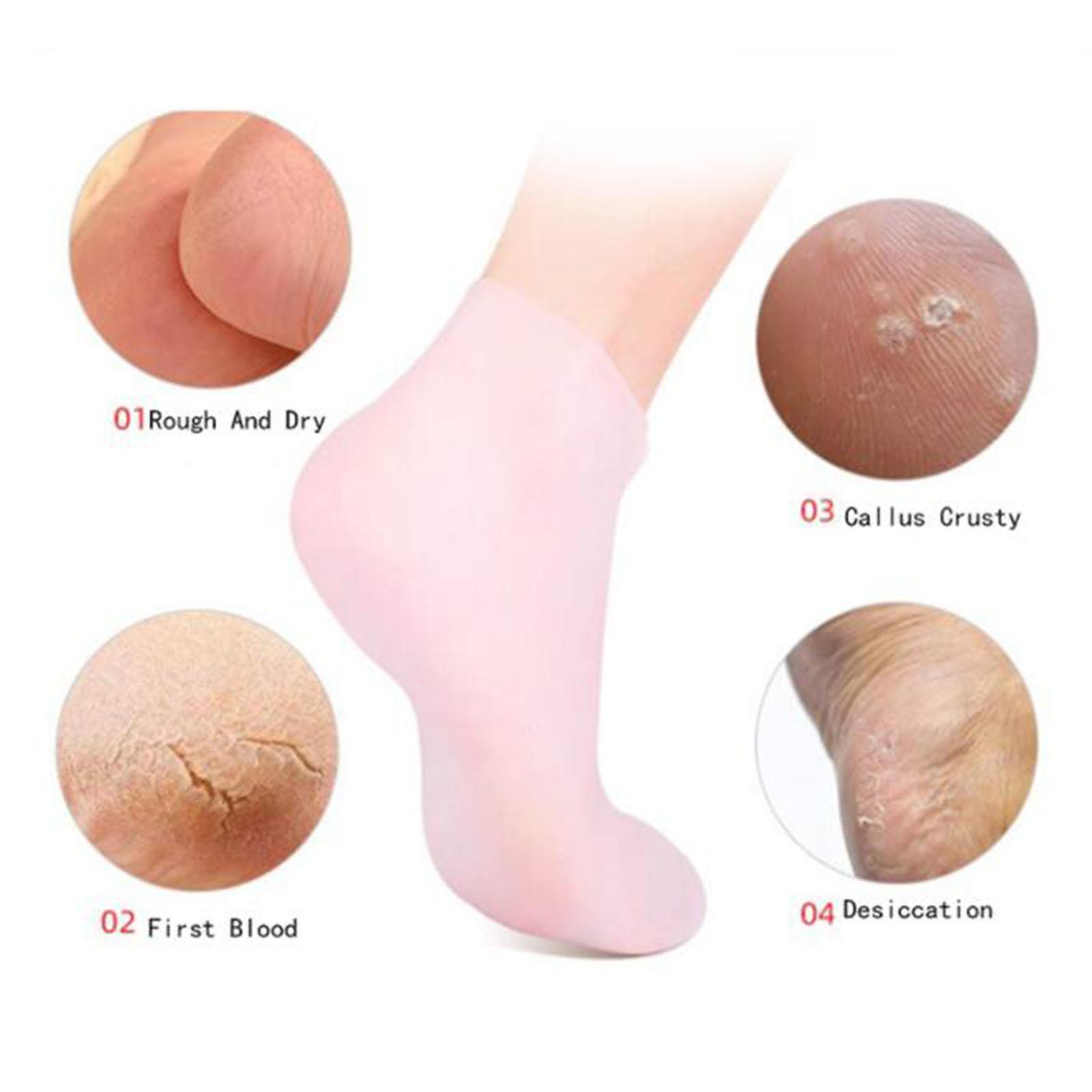 Soft Silicone Gel Socks Toe So - Xl Skincare reseña y precio
