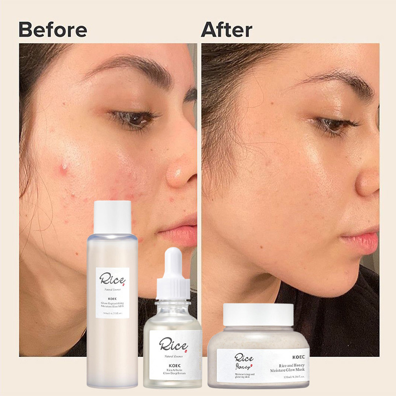 Korean Brand Rice And Honey Sk - Skincare Glad2Glow reseña y precio