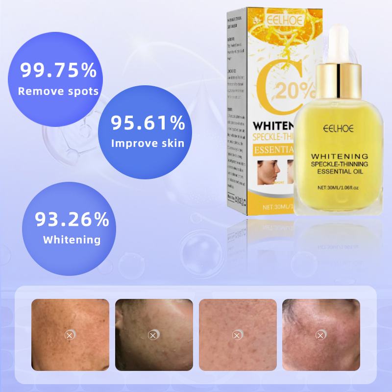 Dark Spots, Lighten Freckles M - Skincare Glad2Glow reseña y precio